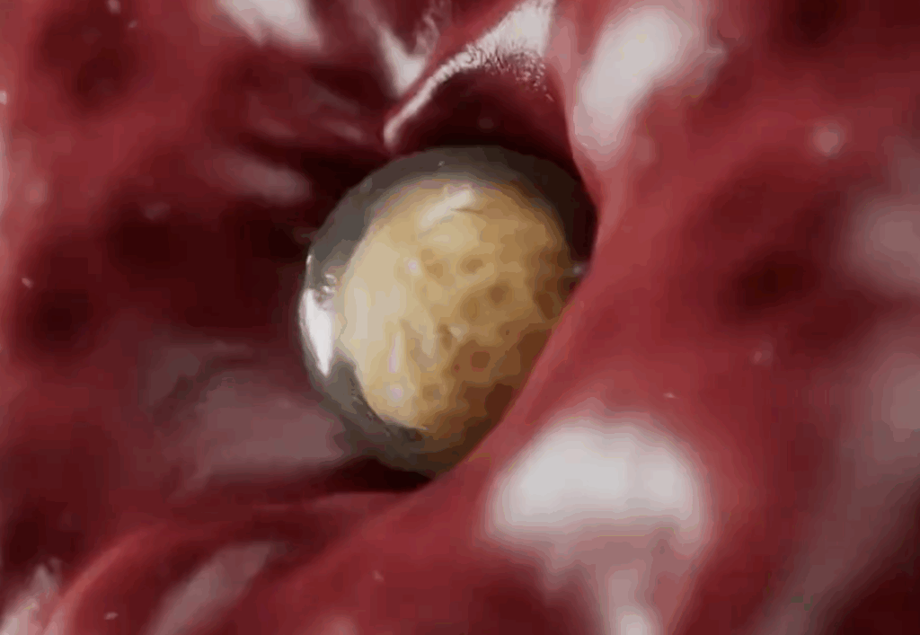 Une nanoparticule lipidique ARNm qui s'infiltre partout (image issue du film "Inside the mRNA vaccine")