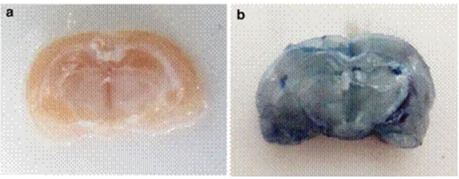 Biochips dans vaccins covid Part 3 Figure 12